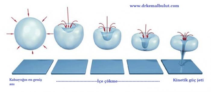 http://www.drkemalbulut.com/sites/default/files/styles/enbuyuk/public/cavitation.jpg?itok=haAsfCZO