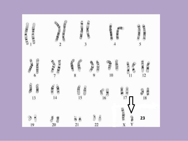 Normal erkekte karyotip analizi, toplam 23 çift kromozom, biri anne biri babadan olmak üzere 22 si otozomal çiftler, 23. çift cinsiyet kromozomlarıdır, X anneden ,Y babadan gelir