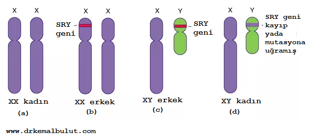 Y kromozomu kısa kolunda yerleşmiş olan SRY geni cinsiyeti belirlemektedir. SRY gen bölgesinin mutasyonu yada diğer kromozomlara geçişi cinsiyet bozuklukları ve infertilite nedenidir. 