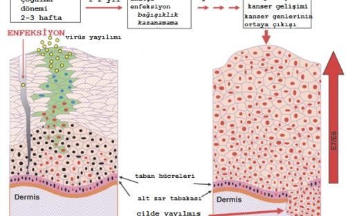 HPV virüsü cilt yoluyla bulaştığında cildin en yüzeyel tabakası olan epidermiste en tabanda bulunan hücreler içinde çoğalır, yüzeye doğru göç ederek, en üst hücrelerde dökülmeye sebep olurken bu hücrelerin içinde kendini de yaymış olur, bağışıklık gelişmez ise uzun süreler sonunda kanser oluşumuna neden olabilir.