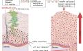 HPV virüsü cilt yoluyla bulaştığında cildin en yüzeyel tabakası olan epidermiste en tabanda bulunan hücreler içinde çoğalır, yüzeye doğru göç ederek, en üst hücrelerde dökülmeye sebep olurken bu hücrelerin içinde kendini de yaymış olur, bağışıklık gelişmez ise uzun süreler sonunda kanser oluşumuna neden olabilir.