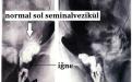 TRUS eşliğinde seminal aspirasyon ve vezikülografi
